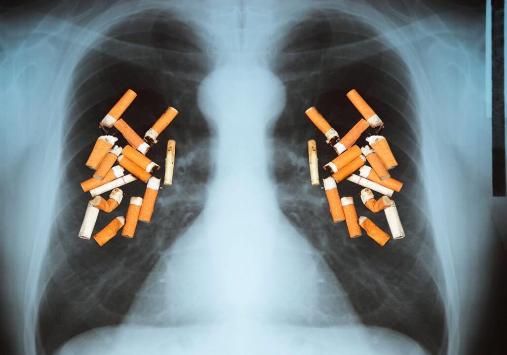 Kaip cigaretės veikia plaučius